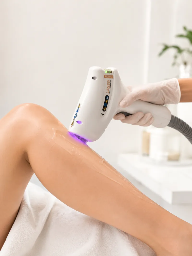 Laser hair removal handpiece applied to a client's leg